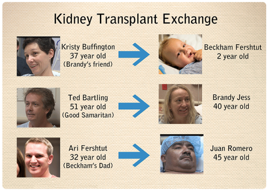 kidney-exchange-chart